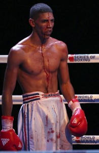 Marcos Forestal Caudín