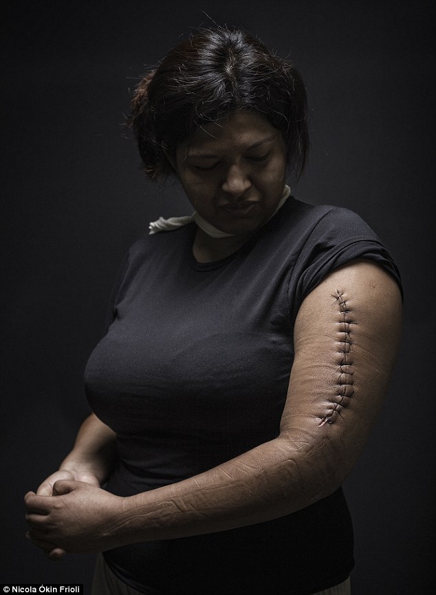 Survivor: Mariana, 29, from Honduras was assaulted yet able to avoid rape during her crossing as an undocumented person through Mexico, with the intent to arrive in the United States